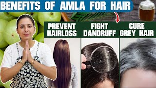 आंवला क्यों खाना चाहिए  Hair, Skin & Health Benefits of Amla Juice | Upasana ki Duniya