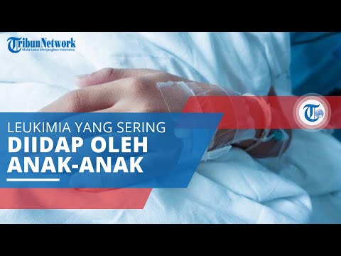 Video: Leukemia Limfoblastik - Gejala, Leukemia Limfoblastik Akut Pada Anak-anak