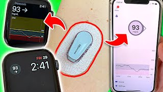 How to View Blood Sugars on Phone and Watch: 4 Tips for Dexcom Users screenshot 5