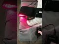 crazy improvement for neuropathy! 880nm NIR laser!