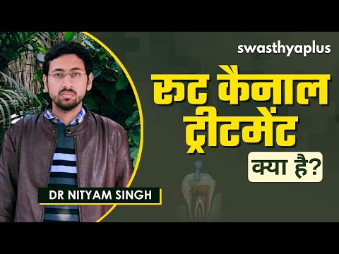 क्या आप भी दांतों में आरसीटी कराने से डरते हैं? | Root Canal Treatment in Hindi | Dr Nityam Singh