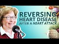 Heart Attack Survivor Reverses Heart Disease With Plant-Based Diet