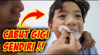 XAVIER TAKUT CABUT GIGI SENDIRI ? Tanpa ke Dokter Gigi Kids Dentist | Vlog Lucu | CnX Adventurers