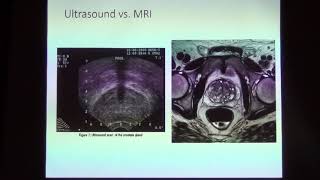 538. Bernadette Greenwood BSc, RT- Prostate Cancer Diagnosis & Treatment- A MRT based approach