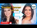 Kendall Jenner transformation throughout the years: plastic surgery braces before and after pictures