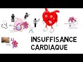 insuffisance cardiaque de A à Z