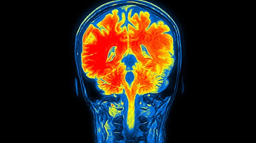 Powerful Brain Imaging Tool