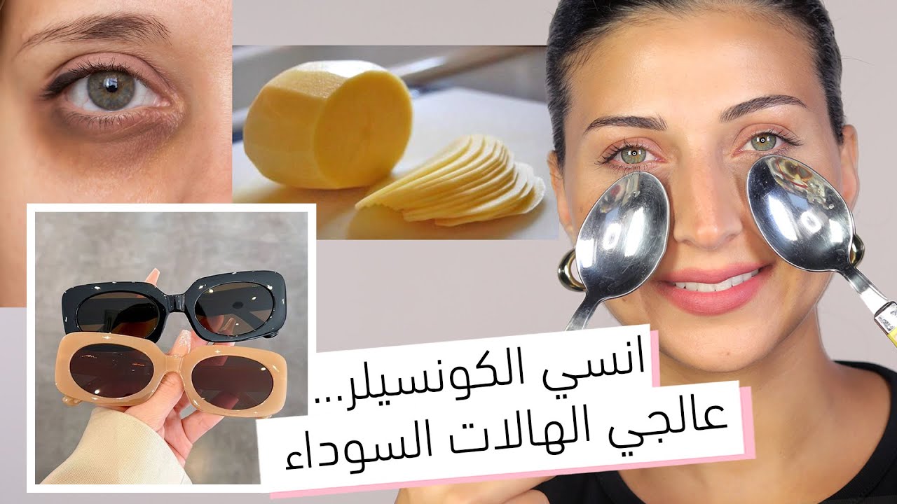 ٨ حيل لتتخلّصي بسرعة من الهالات السوداء والانتفاخ تحت العين  | لن تحتاجي إلى الكونسيلر