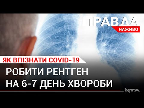 Як відрізнити коронавірус від ГРВІ і чи варто ізольовуватися при перших симптомах.