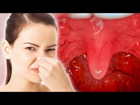15 Cosas que deberías hacer y evitar para no tener mal aliento