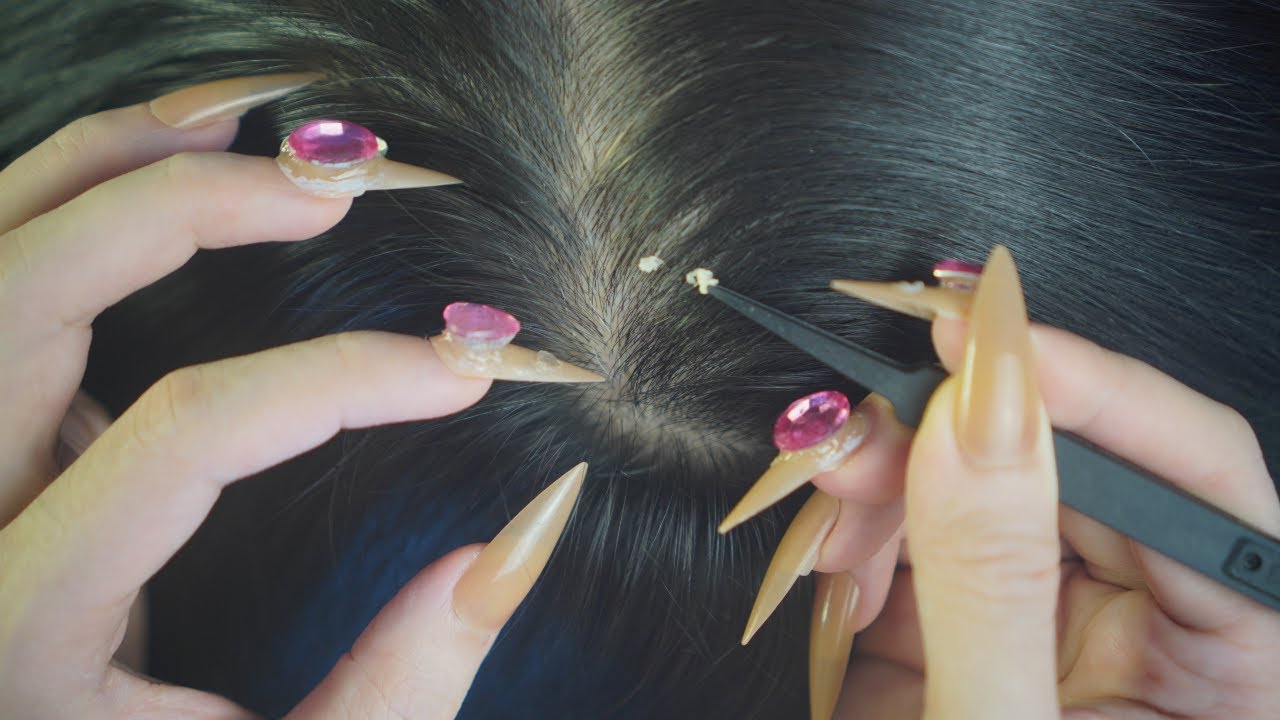 ASMR Scalp Check, Scalp Scratching | Gentle Hair Parting For Sleep ( No Whisper )