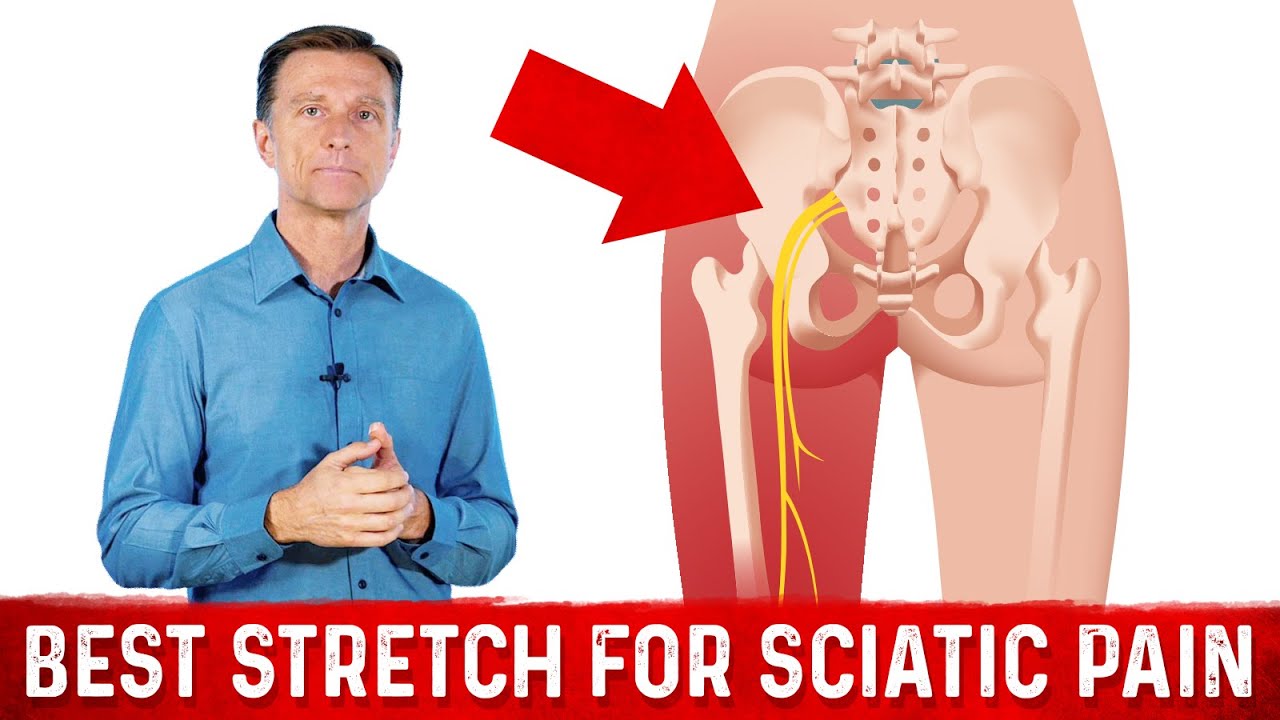 Replying to @ladycarolinachs Sciatic nerve pain #fyp #sciaticnerve #s, sciatica  pain relief