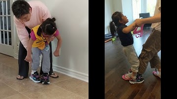 Iris before and after 5 months of Trexo Home use