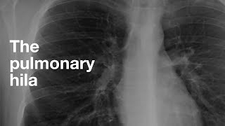 The Pulmonary Hila