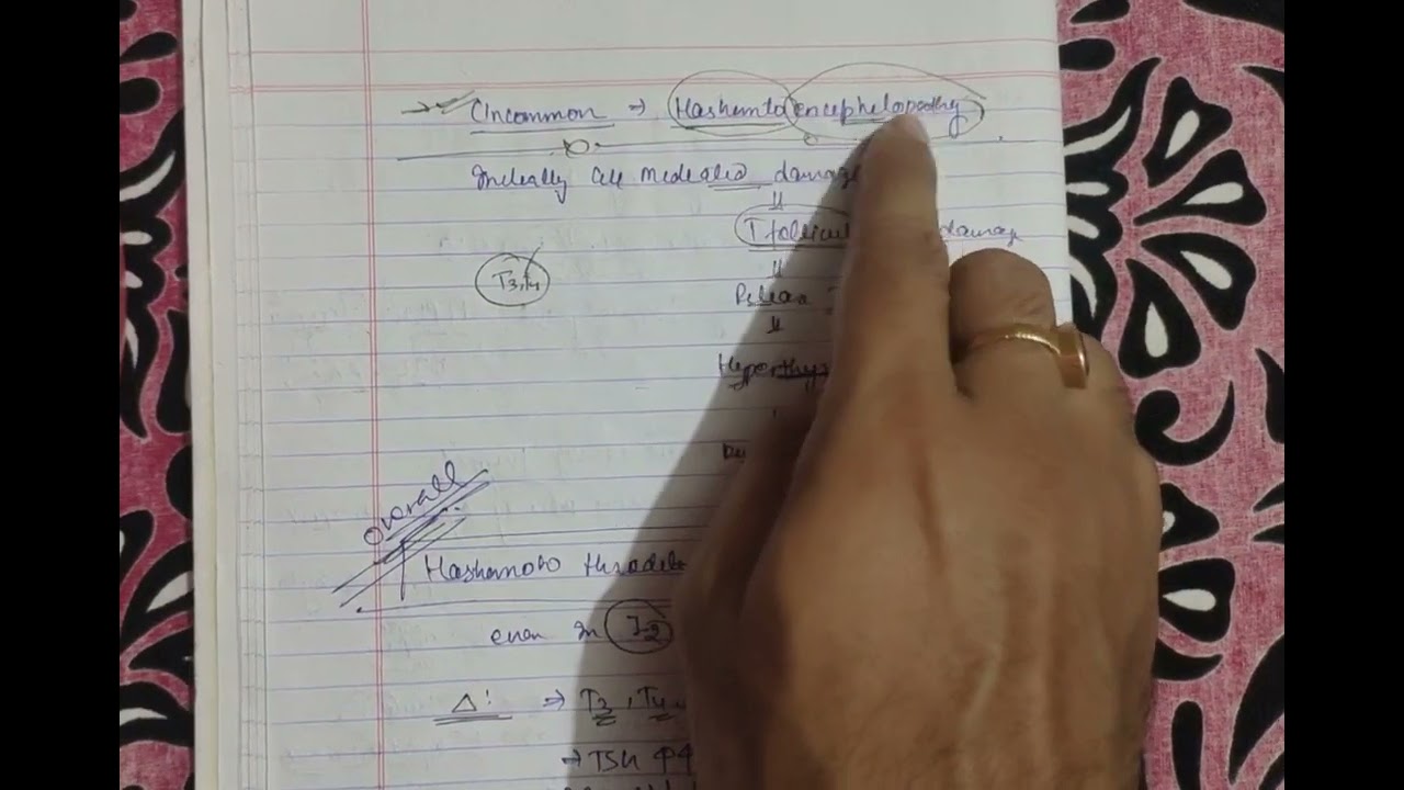 HASHIMOTO THYROIDITIS | ENDOCRINE PATHOLOGY | MBBS | SECOND YEAR .