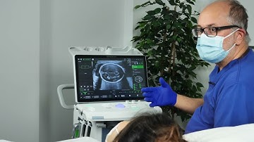 Voluson™ SonoLyst - Suite of AI Tools to Help Automatically Identify Fetal Anatomy