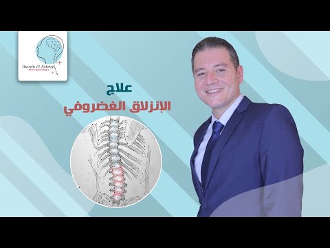 الانزلاق الغضروفي أ د عاطف حسين البقيعي إستشاري جراحة المخ والأعصاب والعمود الفقري