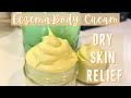 How to Make Homemade Eczema Cream | DIY Natural Itch Relief for Dry Skin