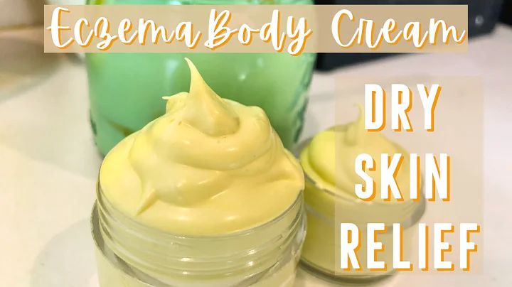 How to Make Homemade Eczema Cream | DIY Natural It...