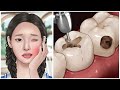 [ASMR] 이가 너무 아파요! 충치 치료 애니메이션 / cavities treatment animation