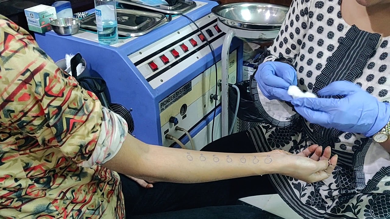 Allergy testing by skin prick method: Dr Sarika Verma - YouTube