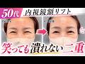 【57歳 額リフト】生活が楽になる✨垂れて見えるまぶたをスッキリと二重が見える目に改善👁️💡【内視鏡前額リフト】