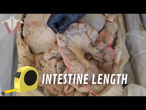 Are Intestines Really 20 Feet Long??? Let's Measure Them!!