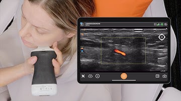 Vessel Depth AI for Aesthetics