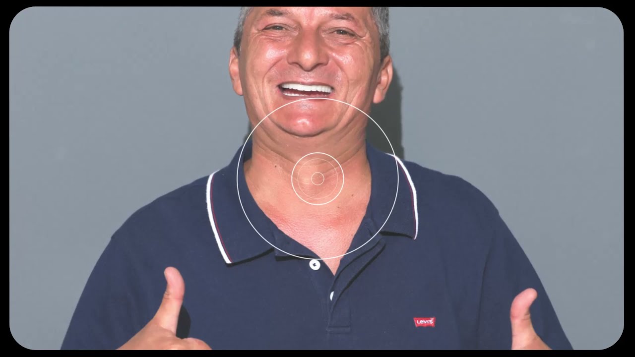 Dental Implants Treatment Bone Grafting Sinus Lifting Surgery Smile Center Turkey