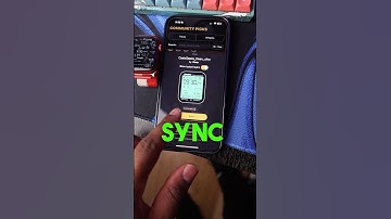 Best Apple Watch face app 🥶