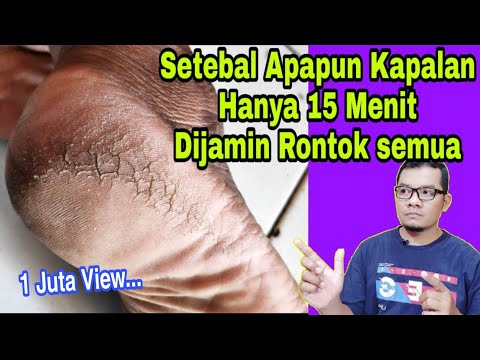 KAPALAN, KAKI PECAH-PECAH 15 MENIT RONTOK, BERSIH SEMUA