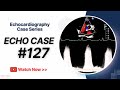 ECHO CASE 127: Echocardiography For Beginners