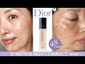 【コンシーラー検証】ディオールの神コンシーラーでアラフィフの最強シミ＆肝斑をナチュラルに隠す【Dior】