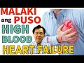 Malaki ang puso high blood heart failure  payo ni doc willie ong 436