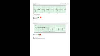 solvedRelias Dysrhythmia Basic A Test 35 Questions and Answers 2023