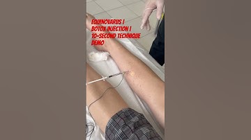 Equinovarus | Botox Injection | 10-Second Technique Demo