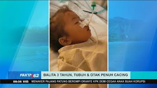 Raya, Balita di Sukabumi Meninggal dengan Tubuh Dipenuhi Cacing Gelang