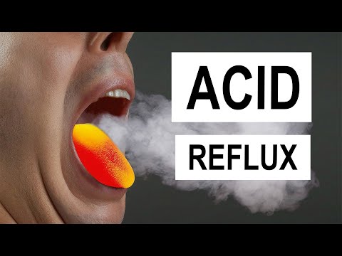 How Acid Reflux