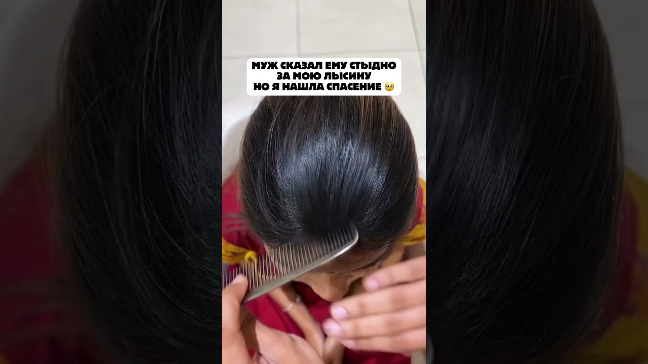 Артикул💚Яндекс: YM10209673 💚Али: ALI4126961027