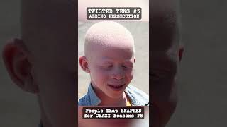 Albino Persecution People That Snapped For Crazy Reasons