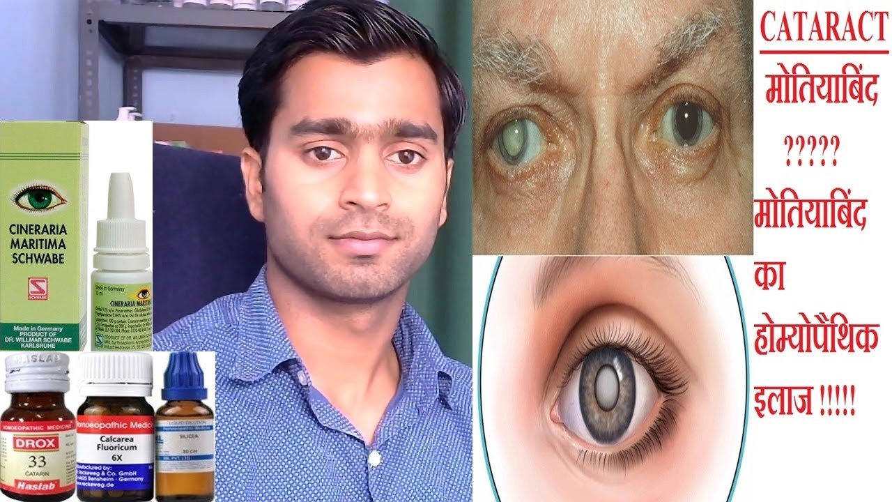 Cataract Homeopathic medicine for cataract !! मोतियाबिंद का