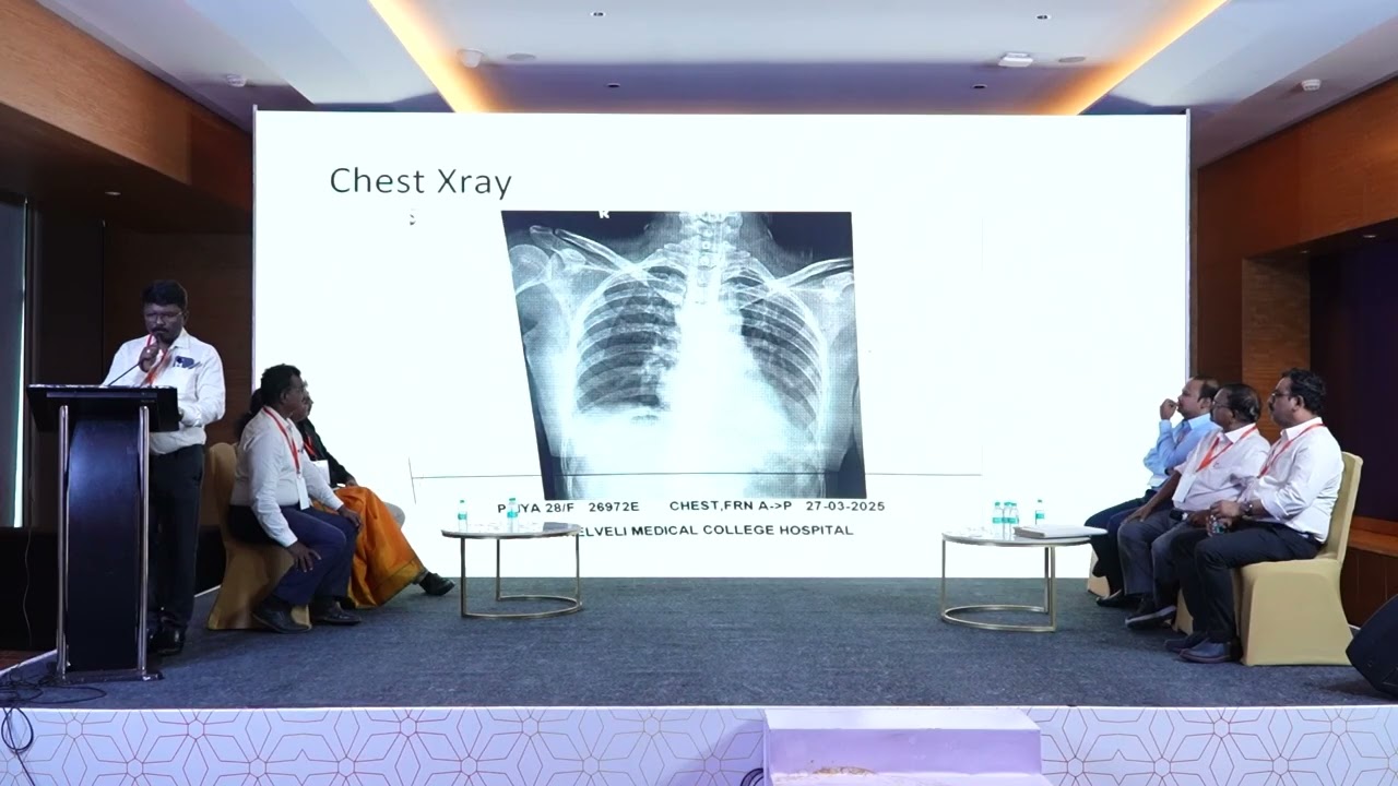 An Interesting Case of Snake Bite