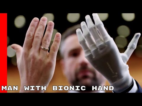 Man With Bionic Hand