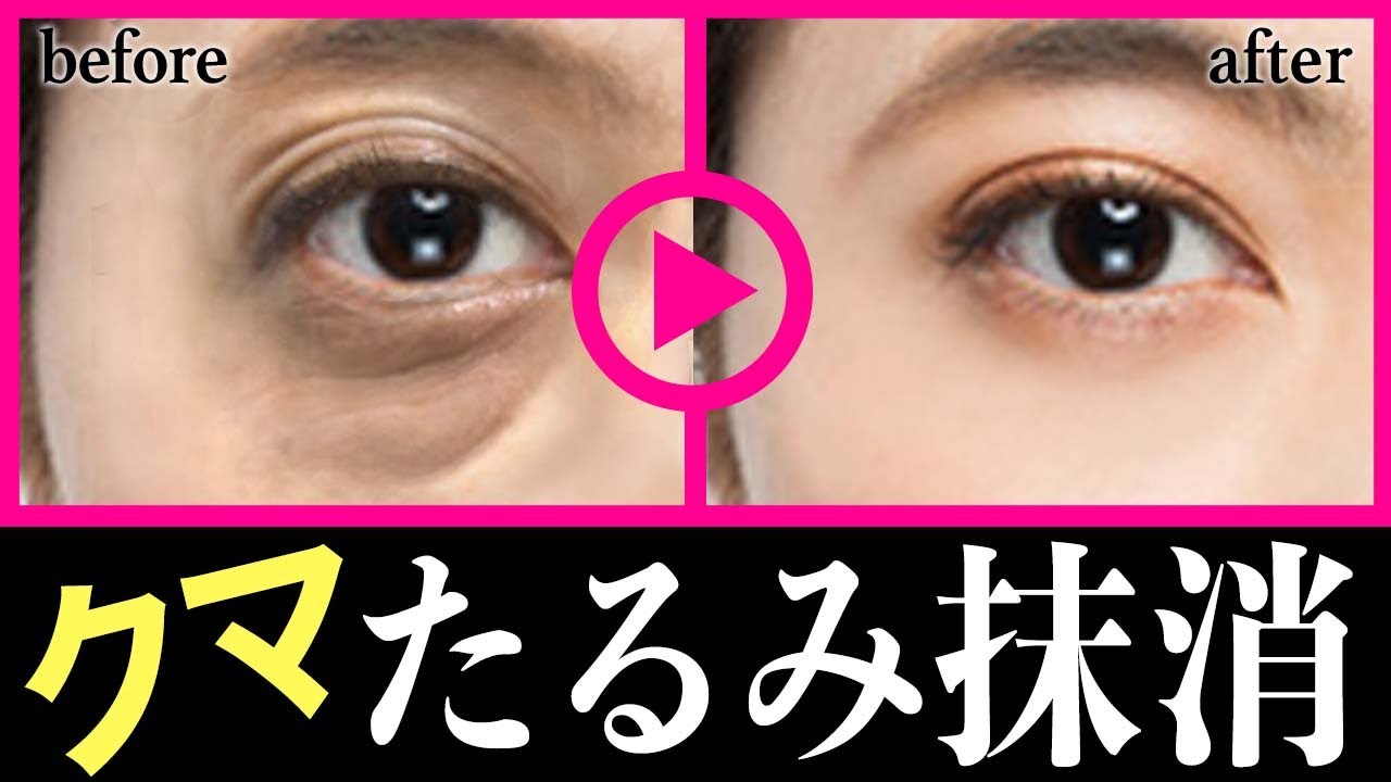 Глаза Медвежья слабость Тщательное стирание