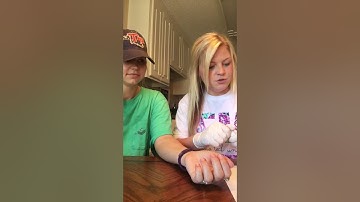 KINE 220 Video 2 Assignment Bandaging a Wound