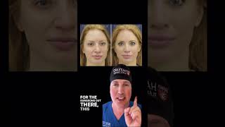 Complex revision rhinoplasty: the crooked nose.