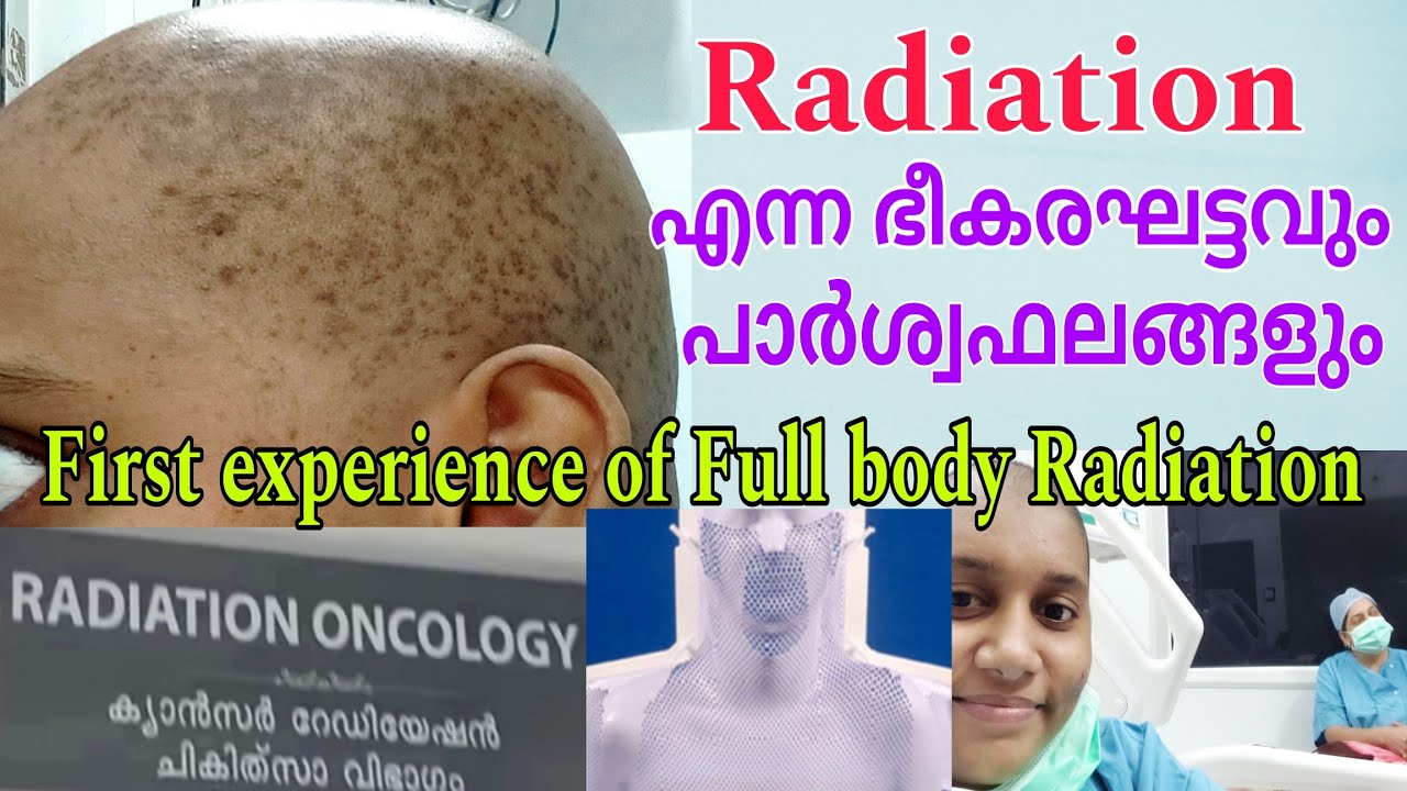 😷😓First experience of Full body Radiation☠️👽..Making of Lungs