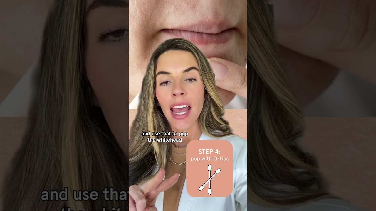 4 Easy Steps to Treat a Whitehead