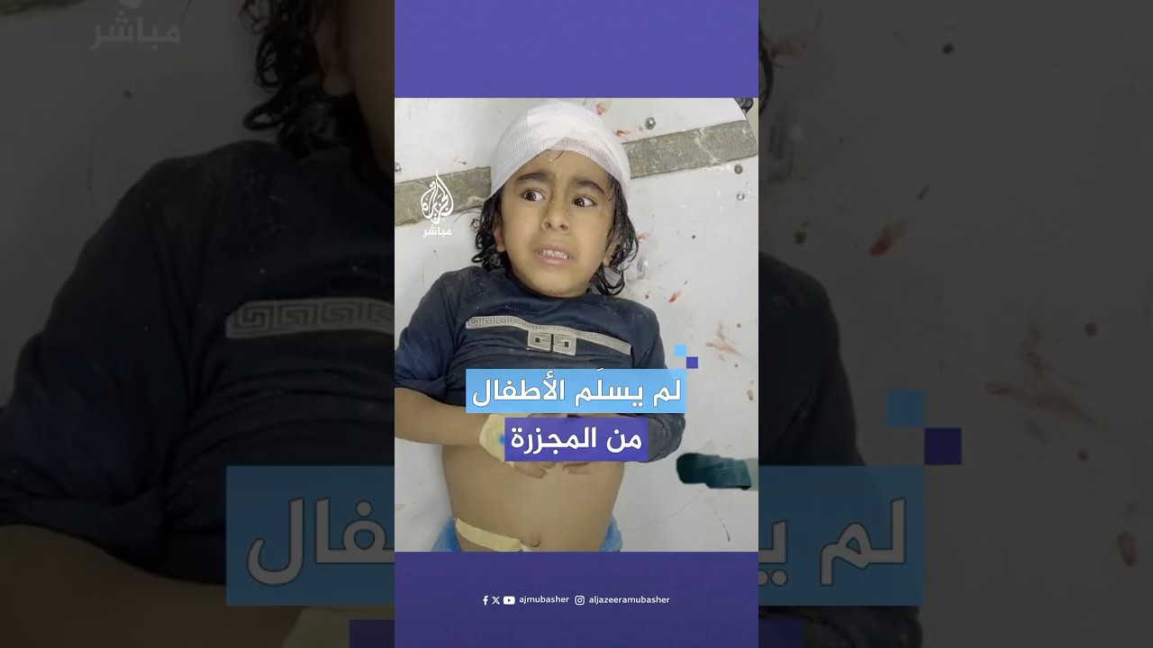 طفل يرتجف بعد إصابته بقصف إسرائيلي استهدف مدرسة تؤوي نازحين في خان يونس جنوبي قطاع غزة