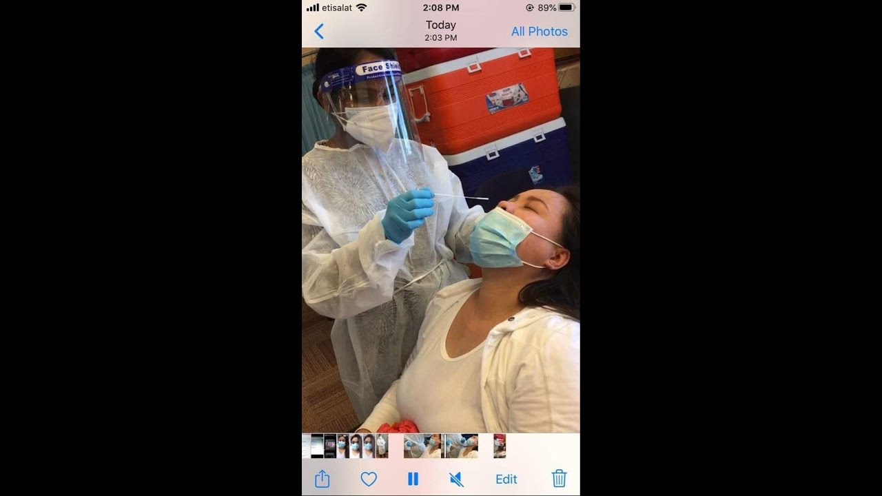 Nasal Swab Test (C.V)